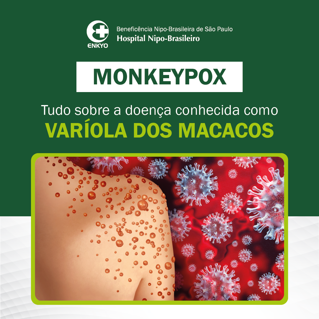 Macacos transmitem monkeypox? Entenda a relação do animal com a doença